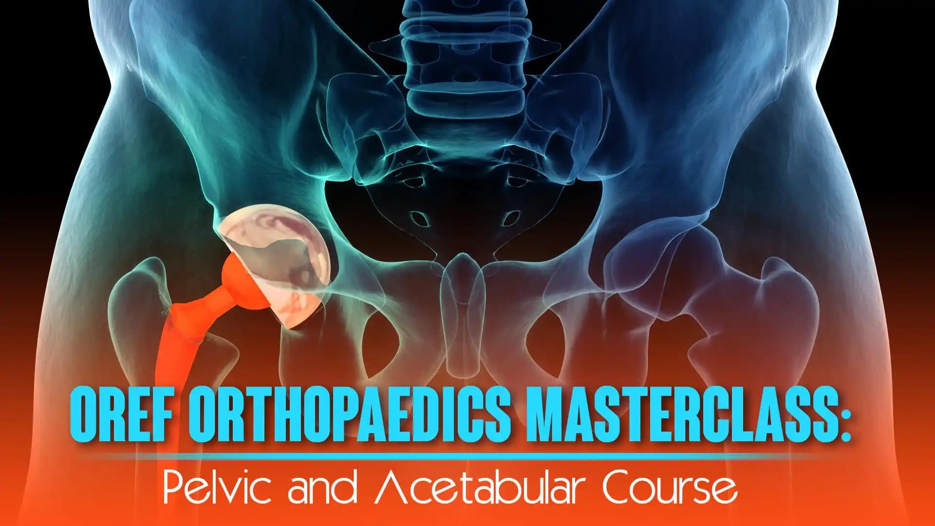 OREF Orthopaedics Masterclass: Pelvic and Acetabular Course