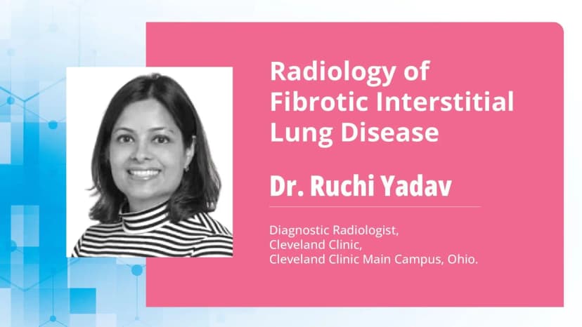 Part 2: Deciphering Radiological Findings in Clinical Fibrotic Interstitial Lung Diseases (ILD)