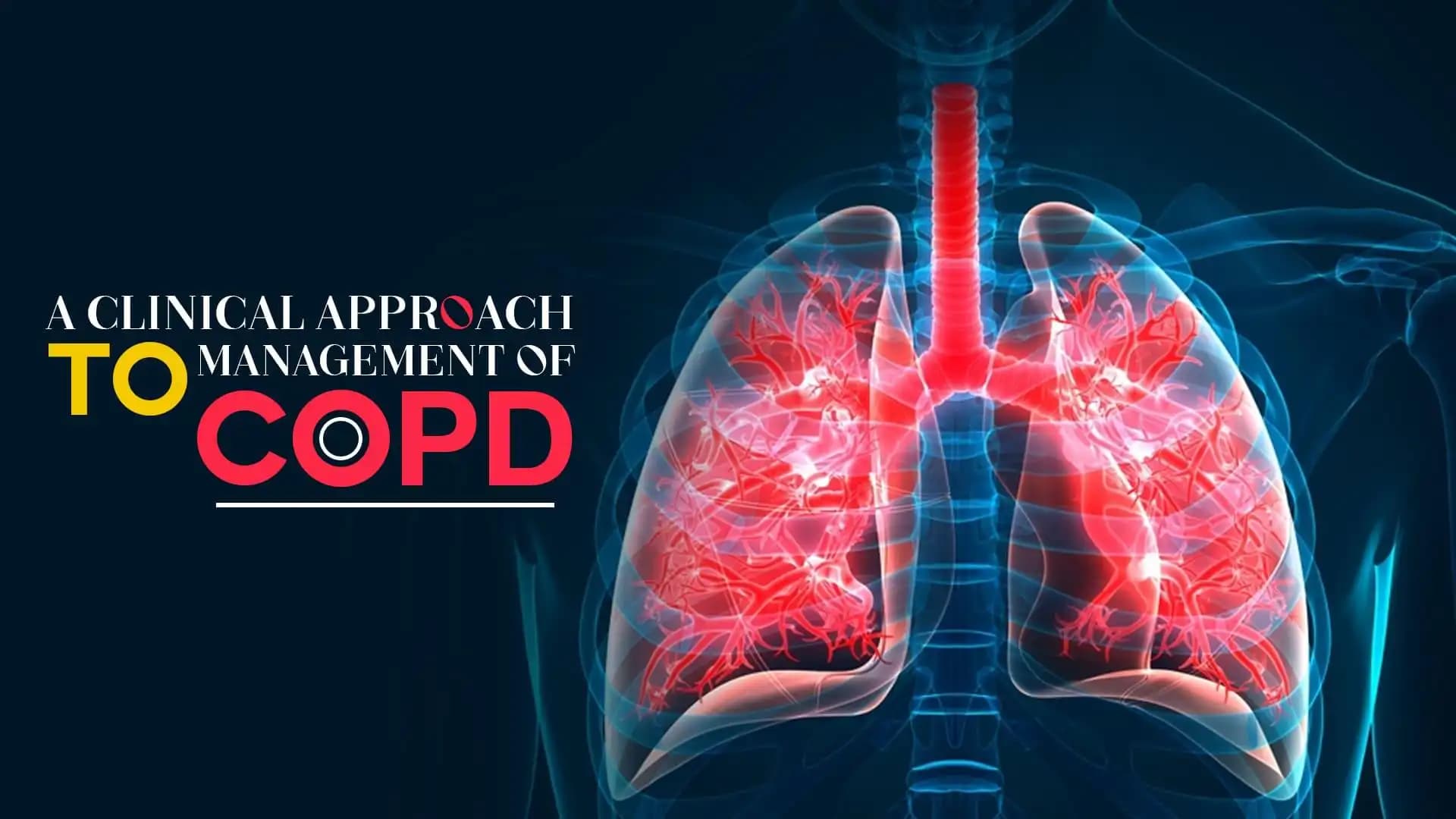 A Clinical Approach to Management of COPD