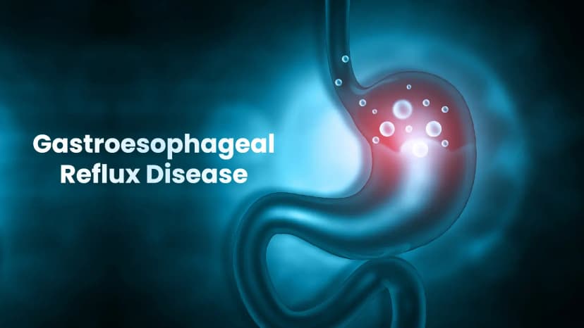 An Overview of Hiatus Hernia