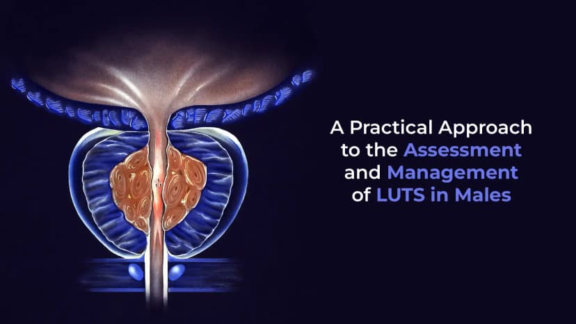 Management of LUTS