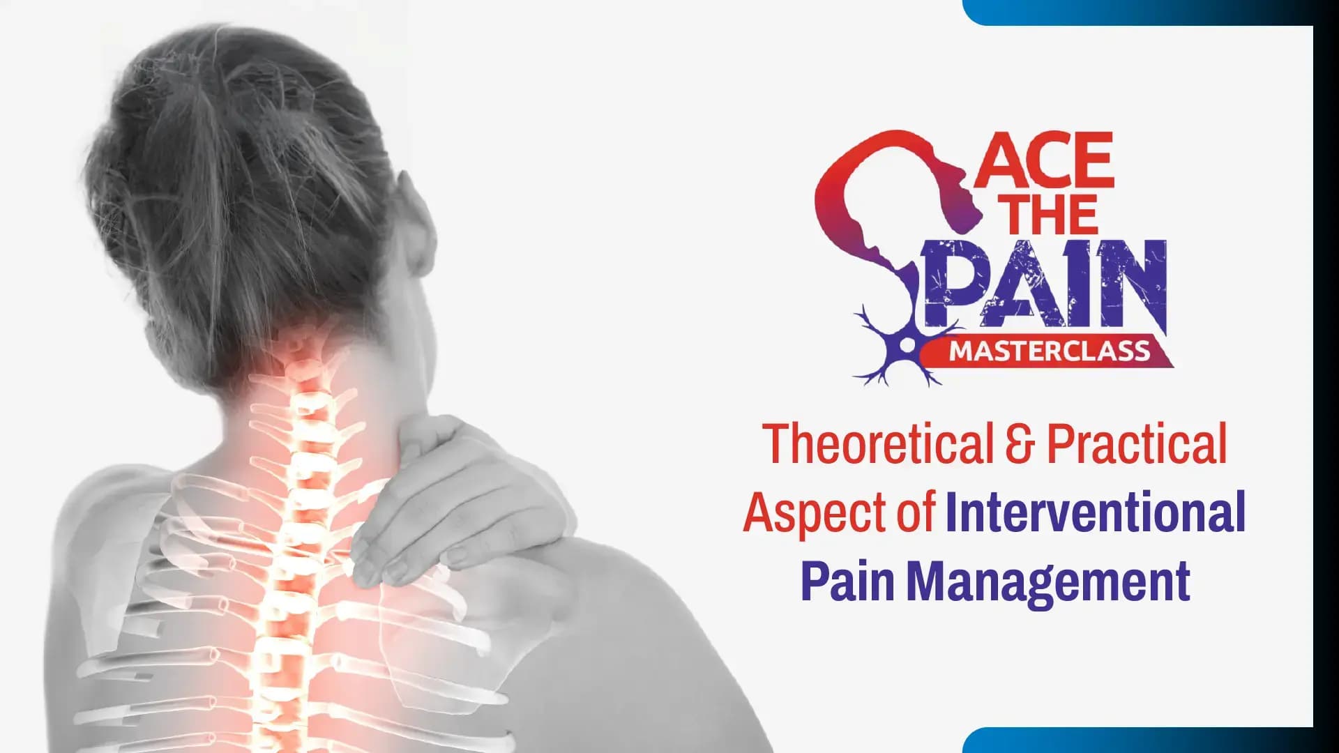 Ace the Pain Masterclass: Theoretical & Practical aspect of Interventional Pain Management