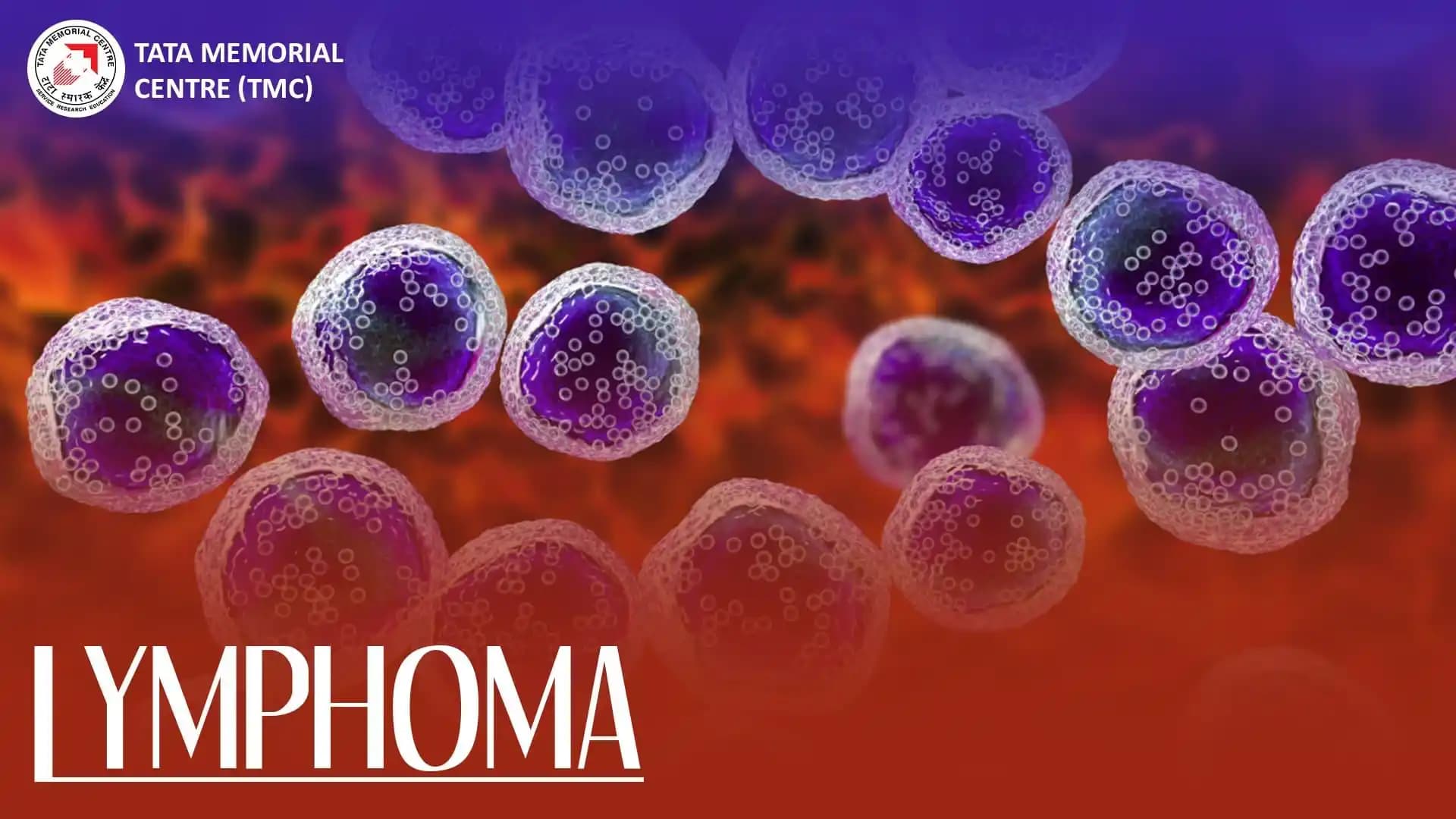 Lymphoma- An Exclusive session by TMC