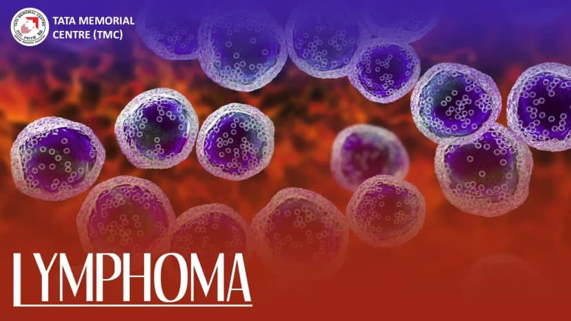 Management Of Extranodal MZL (MALToma)