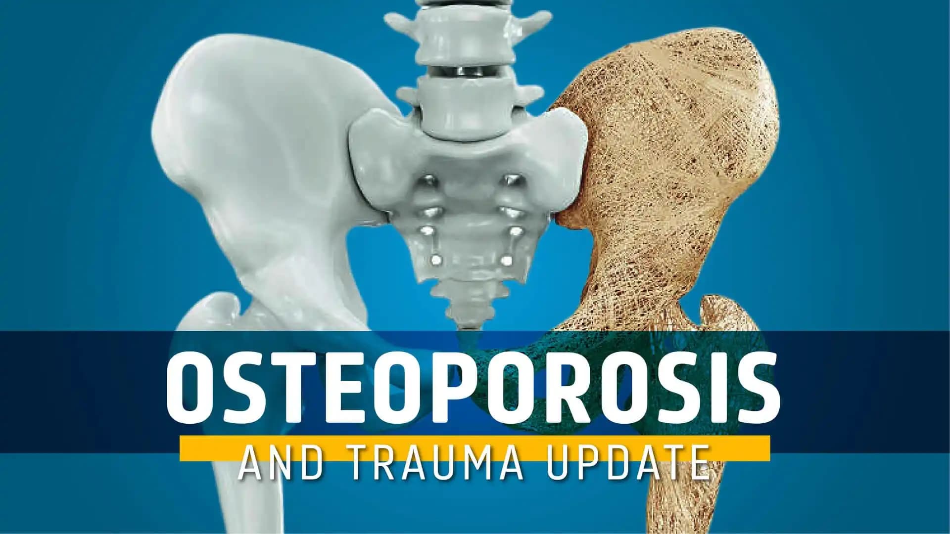 Osteoporosis and Trauma Update