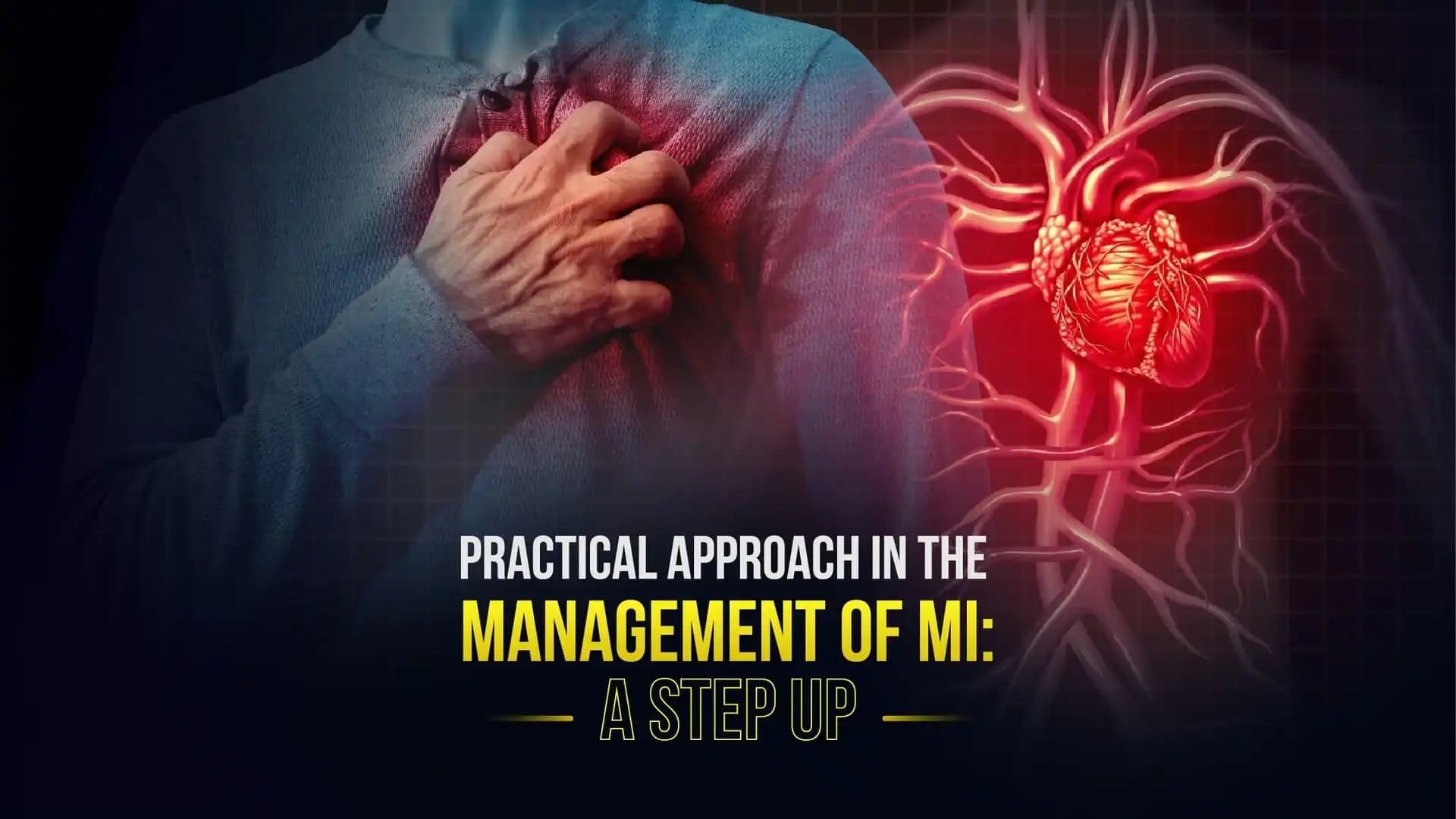Practical Approach in the Management of MI: A Step Up
