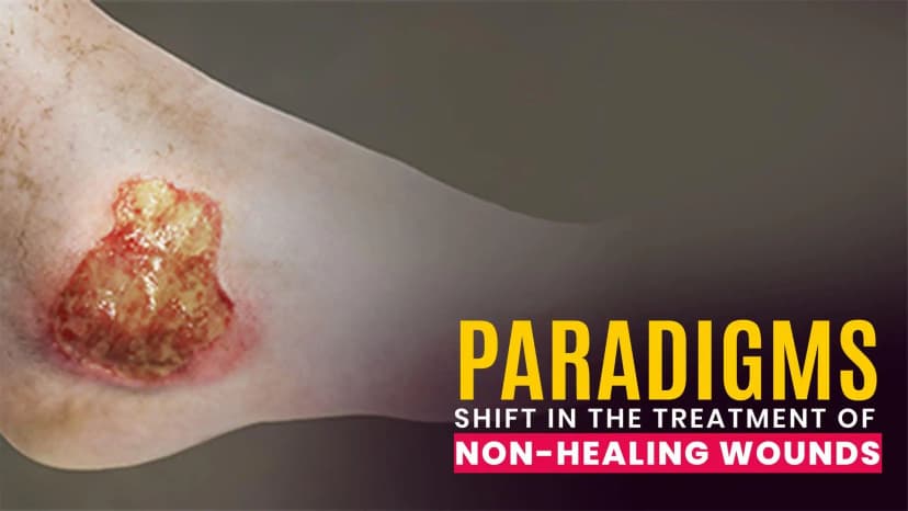 Paradigms Shift in the Treatment of Non-healing Wounds