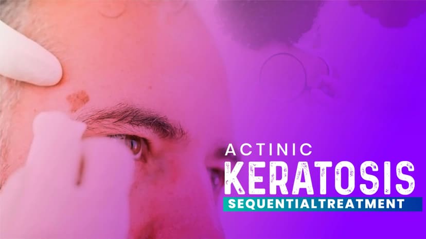Actinic Keratosis - Sequential Treatment
