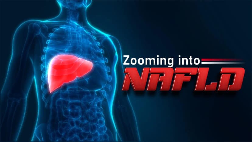 Non-Alcoholic Fatty Liver Disease