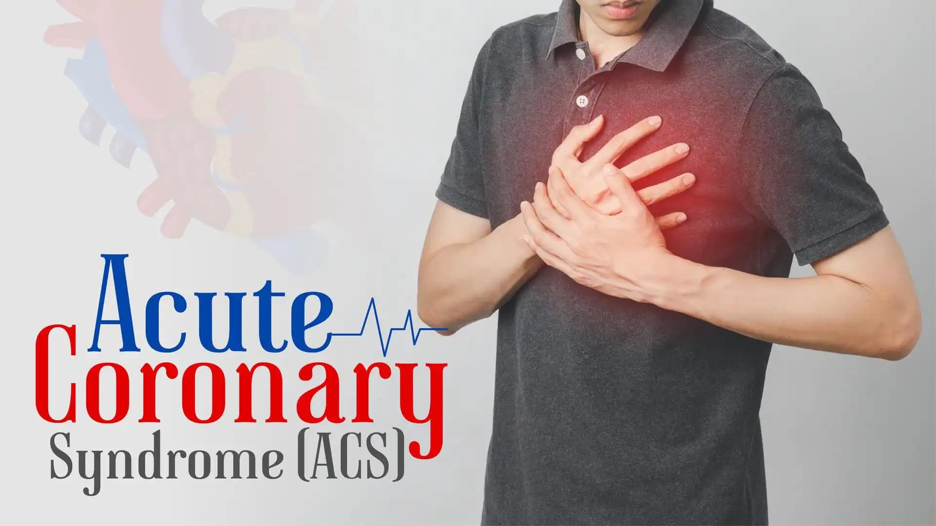 Acute Coronary Syndrome (ACS)