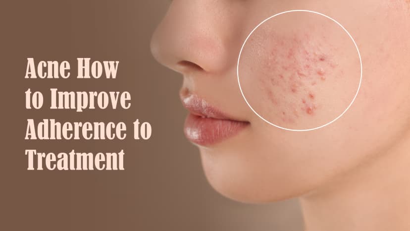 Acne How to Improve Adherence to Treatment
