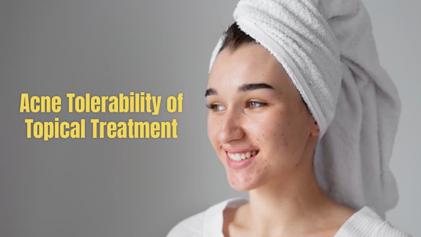 Acne Tolerability of Topical Treatment