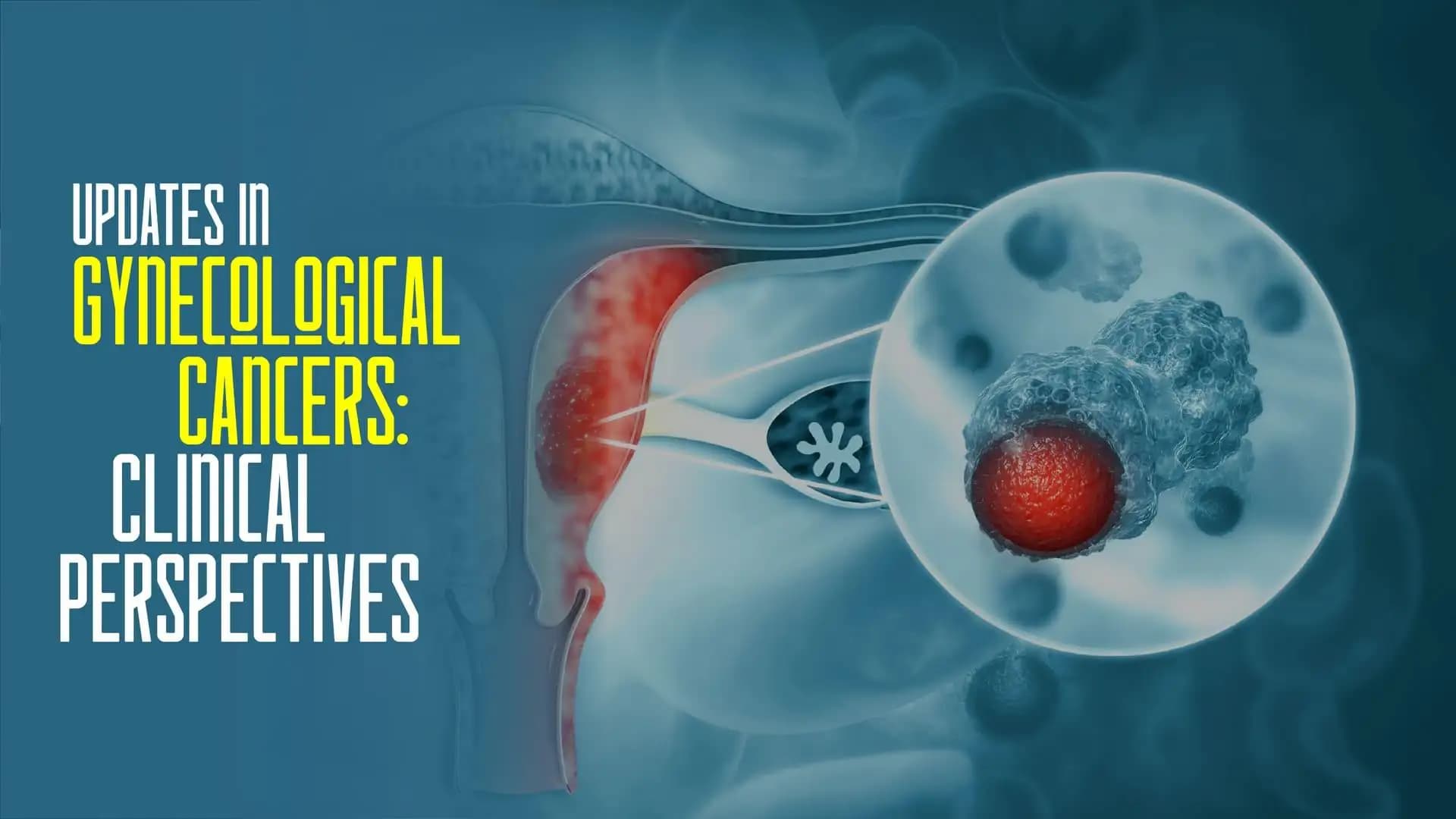 Updates in Gynecological Cancers: Clinical Perspectives