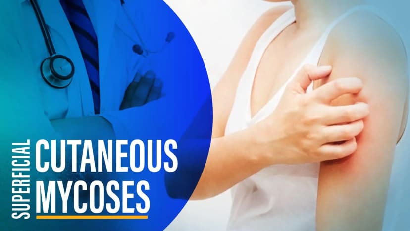 Overview of Cutaneous Mycoses