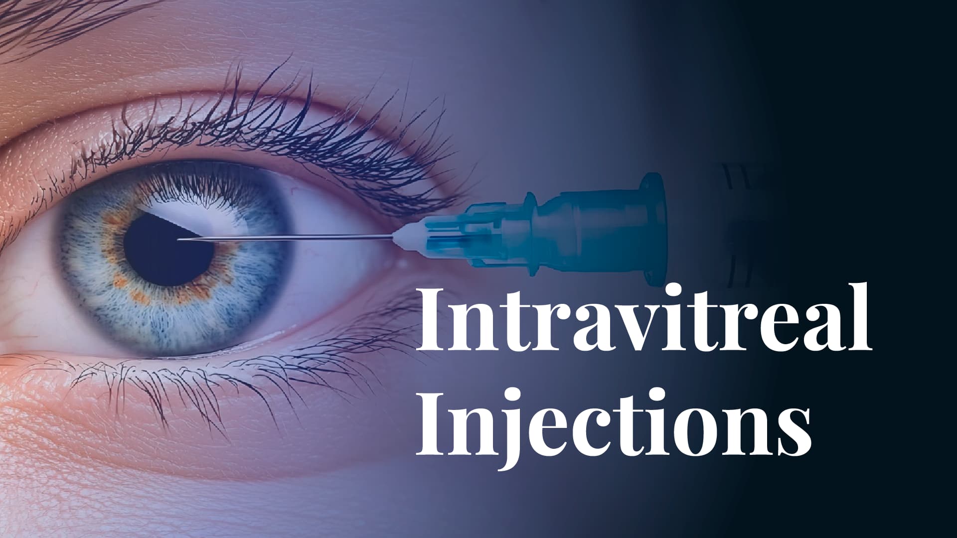 Intravitreal Injections